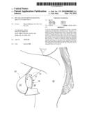 Bra Pad and Method of Relieving Breast Engorgement diagram and image