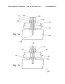 Bearing Device for the Vibration-Decoupled Rotatable Support of an Intermediate Shaft on the Engine Block of a Motor Vehicle, and Method for the Vibration-Decoupled Rotatable Support of an Intermediate Shaft on the Engine Block of a Motor Vehicle diagram and image