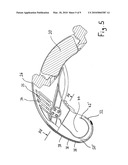 BRAKE DUST COLLECTING DEVICE diagram and image