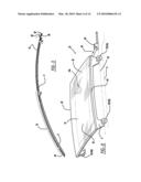 Automotive Vehicle Open Air System diagram and image