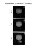 METHODS FOR FAT SIGNAL SUPPRESSION IN MAGNETIC RESONANCE IMAGING diagram and image