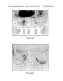 IDENTIFICATION AND ANALYSIS OF LESIONS IN MEDICAL IMAGING diagram and image