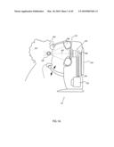 ORTHOVOLTAGE RADIOTHERAPY diagram and image