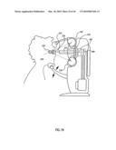 ORTHOVOLTAGE RADIOTHERAPY diagram and image