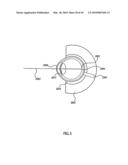 ORTHOVOLTAGE RADIOTHERAPY diagram and image