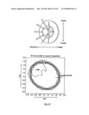 ORTHOVOLTAGE RADIOTHERAPY diagram and image