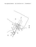 ORTHOVOLTAGE RADIOTHERAPY diagram and image