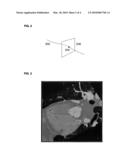 Method and System for Automatic Coronary Artery Detection diagram and image