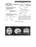 AUTOMATIC INTERPRETATION OF 3-D MEDICINE IMAGES OF THE BRAIN AND METHODS FOR PRODUCING INTERMEDIATE RESULTS diagram and image