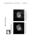 AUTOMATIC INTERPRETATION OF 3-D MEDICINE IMAGES OF THE BRAIN AND METHODS FOR PRODUCING INTERMEDIATE RESULTS diagram and image