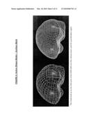 AUTOMATIC INTERPRETATION OF 3-D MEDICINE IMAGES OF THE BRAIN AND METHODS FOR PRODUCING INTERMEDIATE RESULTS diagram and image