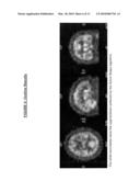 AUTOMATIC INTERPRETATION OF 3-D MEDICINE IMAGES OF THE BRAIN AND METHODS FOR PRODUCING INTERMEDIATE RESULTS diagram and image