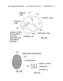 AUTOMATIC INTERPRETATION OF 3-D MEDICINE IMAGES OF THE BRAIN AND METHODS FOR PRODUCING INTERMEDIATE RESULTS diagram and image