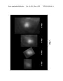 ENHANCED RESOLUTION OF TUMOR METASTASIS USING A SKIN FLAP MODEL diagram and image