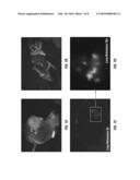 ENHANCED RESOLUTION OF TUMOR METASTASIS USING A SKIN FLAP MODEL diagram and image