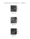 TRANSCRIPTION FACTORS FOR DIFFERENTIATION OF ADULT HUMAN OLFACTORY PROGENITOR CELLS diagram and image