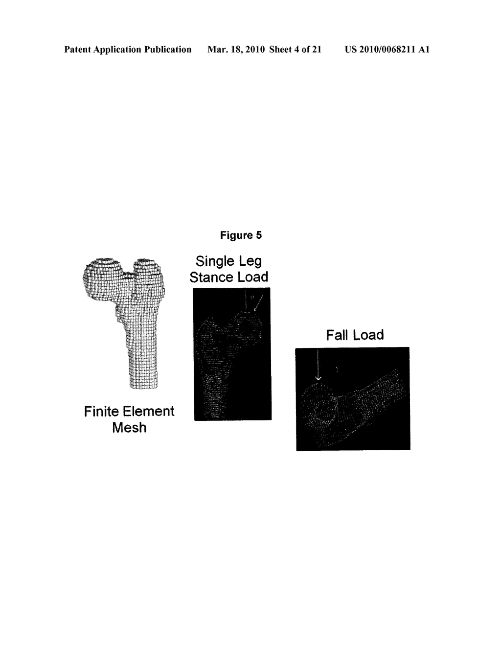 USE OF ANTIRESORPTIVE COMPOUNDS TO PREVENT IONIZING RADIATION-INDUCED ACTIVATION OF OSTEOCLASTS AND RESULTING BONE LOSS - diagram, schematic, and image 05