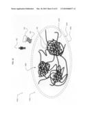 Ex vivo modifiable multiple medicament final dosage form diagram and image