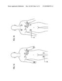 DEVICE FOR MOBILE ELECTROCARDIOGRAM RECORDING diagram and image