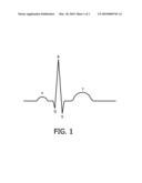 APPARATUS TO MONITOR PULSATING OBJECTS WITHIN THE BODY diagram and image