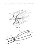 DEVICES AND SYSTEMS FOR DELIVERY OF THERAPEUTIC AGENTS TO BODY LUMENS diagram and image