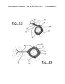 Intravaginal Device with Fluid Transport Plates And Methods of Making diagram and image