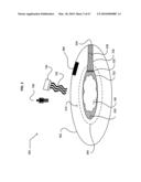 Multiple chamber ex vivo adjustable-release final dosage form diagram and image