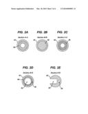 Implantable Pump With Integrated Refill Detection diagram and image