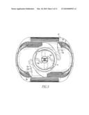 Suture Anchor Inserter diagram and image