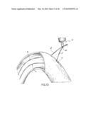 ANASTOMOTIC DEVICE diagram and image