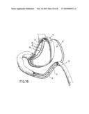 ANASTOMOTIC DEVICE diagram and image