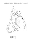 ANASTOMOTIC DEVICE diagram and image