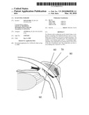 GLAUCOMA SURGERY diagram and image