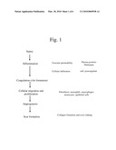 GLAUCOMA SURGERY diagram and image