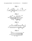 METHOD FOR REDUCING EMBOLI FORMATION diagram and image