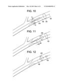 METHOD FOR REDUCING EMBOLI FORMATION diagram and image