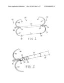 METHODS FOR FACILITATING CLOSURE OF A BODILY OPENING USING ONE OR MORE TACKING DEVICES diagram and image