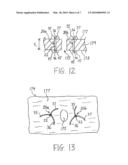 METHODS FOR FACILITATING CLOSURE OF A BODILY OPENING USING ONE OR MORE TACKING DEVICES diagram and image