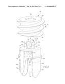 Tenodesis Implant diagram and image