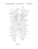 Tenodesis Implant diagram and image