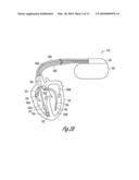 DUAL SENSING FOR BRADY-TACHY PACEMAKER/ICD diagram and image