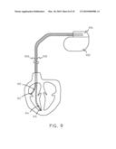 SYSTEMS AND METHODS FOR INCREASING PACING OUTPUT AFTER EXTERNAL HIGH-ENERGY ELECTRICAL SHOCK diagram and image