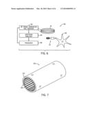 METHODS OF INDUCING PARESTHESIA USING WIRELESS NEUROSTIMULATION diagram and image