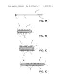 STENTS AND CATHETERS HAVING IMPROVED STENT DEPLOYMENT diagram and image