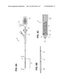 STENTS AND CATHETERS HAVING IMPROVED STENT DEPLOYMENT diagram and image