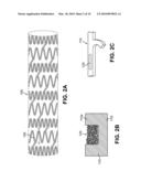 LAYER BY LAYER MANUFACTURING OF A STENT diagram and image
