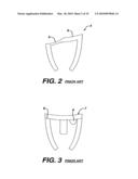 Concave Resurfacing Prosthesis diagram and image