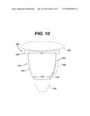 Concave Resurfacing Prosthesis diagram and image