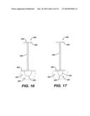 Concave Resurfacing Prosthesis diagram and image