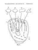 Sports Glove With Impact Force Attenuation System diagram and image